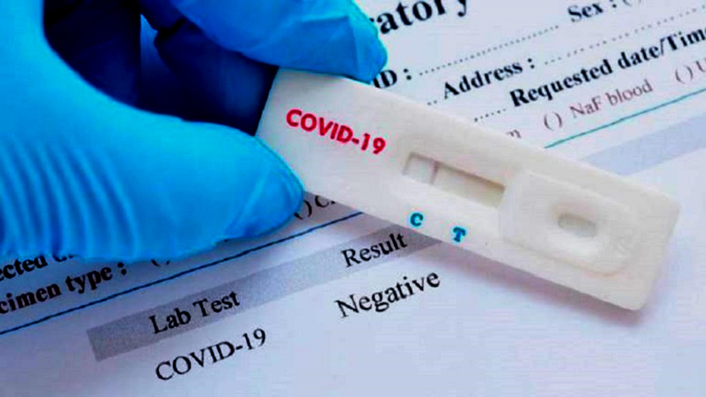El Ayuntamiento de Villena pasará test de detección del  coronavirus a toda la plantilla municipal.